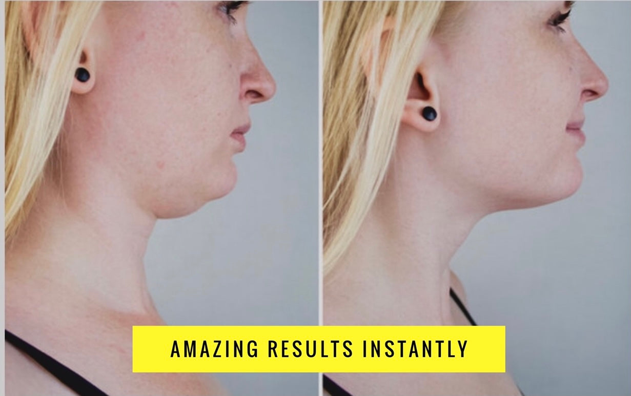 HAPPY CHIN - INSTANT CHIN & NECK LIFT - One Size